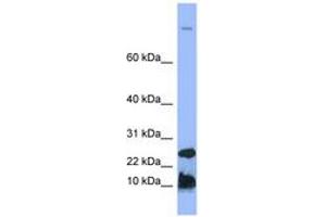 Image no. 1 for anti-Hepcidin Antimicrobial Peptide (HAMP) (N-Term) antibody (ABIN6741742) (Hepcidin antibody  (N-Term))