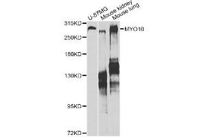 Western blot analysis of extracts of various cell lines, using MYO10 antibody. (Myosin X antibody)