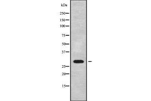 Western blot analysis of EIF3J using A549 whole cell lysates (EIF3S1 antibody  (Internal Region))