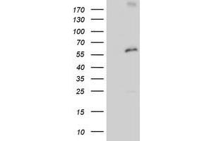 HEK293T cells were transfected with the pCMV6-ENTRY control (Left lane) or pCMV6-ENTRY PSMD3 (Right lane) cDNA for 48 hrs and lysed. (PSMD3 antibody)