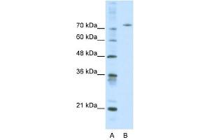 Afamin antibody used at 0. (Afamin antibody  (Middle Region))