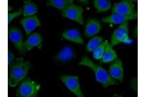 Detection of CAP3 in Human Hela Cell using Polyclonal Antibody to Cytoplasmic Antiproteinase 3 (CAP3) (SERPINB9 antibody  (AA 1-376))