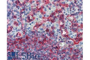 Immunohistochemistry staining of human spleen (paraffin sections) with anti-HLA-E (clone MEM-E/06). (HLA-E antibody)