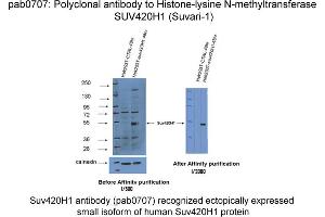 Image no. 1 for anti-Suppressor of Variegation 4-20 Homolog 1 (SUV420H1) antibody (ABIN1735481) (SUV420H1 antibody)
