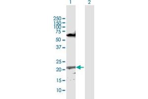 Western Blot analysis of CFC1 expression in transfected 293T cell line by CFC1 MaxPab polyclonal antibody. (CFC1 antibody  (AA 1-223))