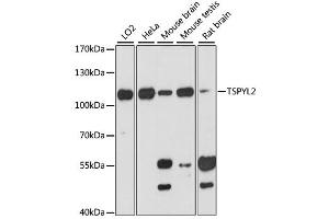Western blot analysis of extracts of various cell lines, using TSPYL2 antibody (ABIN6291999) at 1:3000 dilution. (TSPY-Like 2 antibody)
