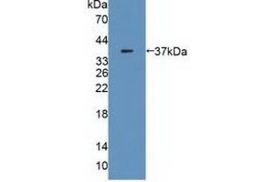Detection of Recombinant MDH2, Human using Polyclonal Antibody to Malate Dehydrogenase 2 (MDH2) (MDH2 antibody  (AA 25-338))