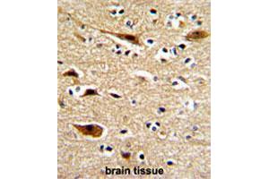 Formalin-fixed and paraffin-embedded human brainreacted with APP polyclonal antibody , which was peroxidase-conjugated to the secondary antibody, followed by AEC staining. (APP antibody  (N-Term))
