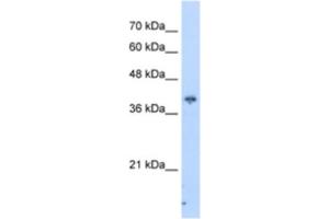 Western Blotting (WB) image for anti-Interaction Protein For Cytohesin Exchange Factors 1 (IPCEF1) antibody (ABIN2462961) (ICEF1 antibody)