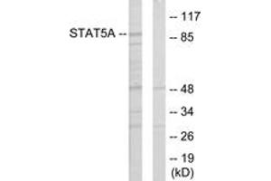 Western Blotting (WB) image for anti-Signal Transducer and Activator of Transcription 5A (STAT5A) (AA 386-435) antibody (ABIN2889477) (STAT5A antibody  (AA 386-435))