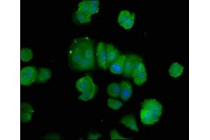 Immunofluorescence staining of MCF-7 cells with ABIN7150235 at 1:100, counter-stained with DAPI. (POLD3 antibody  (AA 203-275))