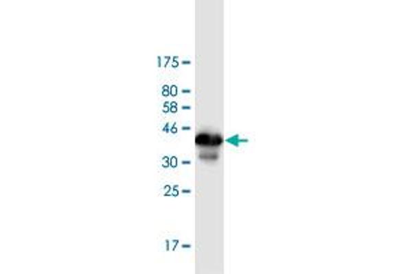 ZBTB6 anticorps  (AA 121-220)