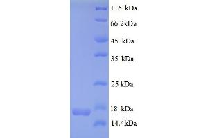 SDS-PAGE (SDS) image for CDKN2A Interacting Protein N-Terminal Like (CDKN2AIPNL) (AA 1-116), (full length) protein (His tag) (ABIN5709267)