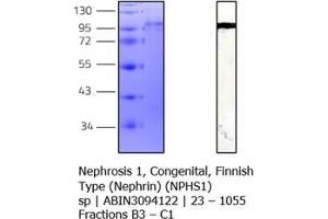 Western Blotting (WB) image for Nephrosis 1, Congenital, Finnish Type (Nephrin) (NPHS1) (AA 23-1055) protein (His tag) (ABIN3094122)