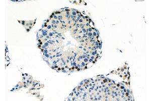 ABIN6260361 and ABIN6266793 at 1/100 staining Mouse testis tissue by IHC-P.