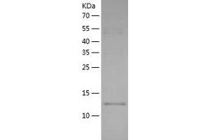 Western Blotting (WB) image for Interleukin 1 alpha (IL1A) (AA 115-270) (Active) protein (His tag) (ABIN7123512)