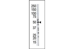 Image no. 1 for anti-Tumor Susceptibility Gene 101 (TSG101) (N-Term) antibody (ABIN357572) (TSG101 antibody  (N-Term))