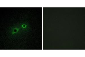 Peptide - +Immunohistochemistry analysis of paraffin-embedded human breast carcinoma tissue, using ENTK antibody. (TMPRSS15 antibody)