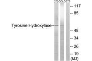 Western blot analysis of extracts from NIH-3T3/COLO cells, treated with Forskolin 40nM 30', using Tyrosine Hydroxylase (Ab-19) Antibody. (Tyrosine Hydroxylase antibody  (AA 10-59))