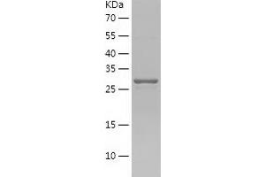 Western Blotting (WB) image for Heparan Sulfate (Glucosamine) 3-O-Sulfotransferase 1 (HS3ST1) (AA 21-307) protein (His tag) (ABIN7284304) (HS3ST1 Protein (AA 21-307) (His tag))