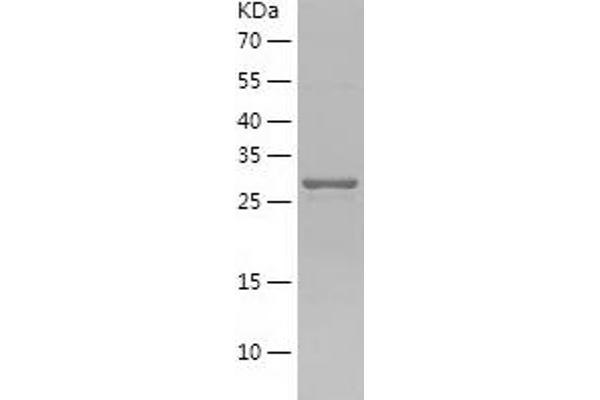 HS3ST1 Protein (AA 21-307) (His tag)