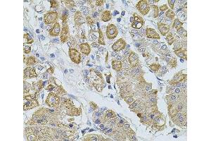 Immunohistochemistry of paraffin-embedded Human stomach using TRPA1 Polyclonal Antibody at dilution of 1:100 (40x lens). (TRPA1 antibody)