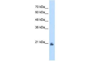 WB Suggested Anti-METTL7A Antibody Titration:  2. (METTL7A antibody  (N-Term))