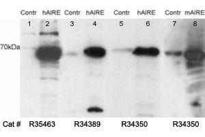 Western blot testing of untransfected (lane 1) and transfected (lane 2) HEK293 cell lysates with AIRE antibody at 0. (AIRE antibody)