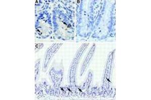Immunohistochemistry (IHC) image for anti-Doublecortin-Like Kinase 1 (DCLK1) antibody (ABIN2895813) (DCLK1 antibody)