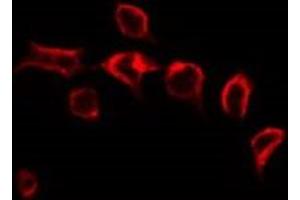 Immunofluorescence (fixed cells) (IF/ICC) image for anti-Heterogeneous Nuclear Ribonucleoprotein A2/B1 (HNRNPA2B1) (N-Term) antibody (ABIN6262328)