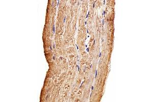 Immunohistochemical analysis of paraffin-embedded H. (MAP4K3 antibody)