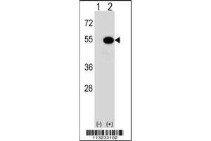 Western blot analysis of MAPKAPK5 using rabbit polyclonal MAPKAPK5 Antibody (T182) using 293 cell lysates (2 ug/lane) either nontransfected (Lane 1) or transiently transfected (Lane 2) with the MAPKAPK5 gene.