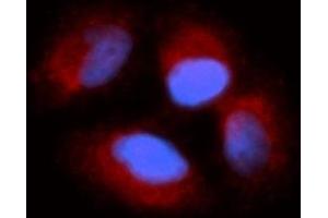 Immunofluorescence (IF) image for anti-Cyclin I (CCNI) (AA 1-377) antibody (PE) (ABIN5565347) (Cyclin I antibody  (AA 1-377) (PE))