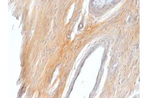 Formalin-fixed, paraffin-embedded Rat Uterus stained with Caldesmon Rabbit Polyclonal Antibody. (Caldesmon antibody)