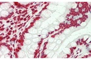 Detection of H3 in Human Small Intestine Tissue using Polyclonal Antibody to Histone H3 (H3) (Histone 3 antibody  (AA 1-136))