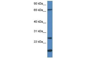 GSTM5 antibody used at 1 ug/ml to detect target protein. (GSTM5 antibody  (N-Term))