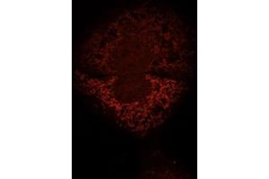 Human HepG2 cells fixed with 3. (IMMT antibody  (AA 241-340))