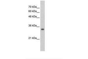 Image no. 1 for anti-Zinc Finger Protein 227 (ZNF227) (AA 301-350) antibody (ABIN203042) (ZNF227 antibody  (AA 301-350))