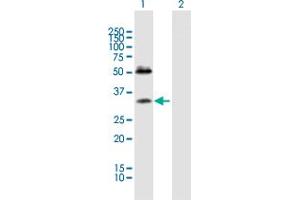 Western Blot analysis of SDC4 expression in transfected 293T cell line by SDC4 MaxPab polyclonal antibody. (SDC4 antibody  (AA 1-198))