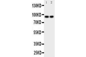 Anti-MALT1 antibody, Western blotting Lane 1: MCF-7 Cell Lysate Lane 2: HELA Cell Lysate (MALT1 antibody  (C-Term))