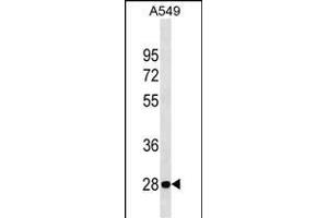 VB Antibody (C-term) 18906b western blot analysis in A549 cell line lysates (35 μg/lane). (VAPB antibody  (C-Term))