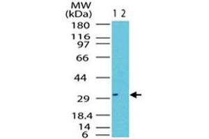 Western blot analysis of RAX in the 1) absence and 2) presence of immunizing peptide in Jurkat cell lysate. (RAX antibody  (AA 300-350))