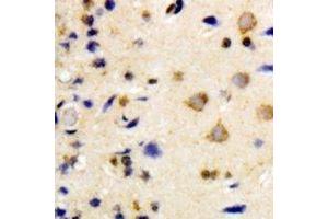Immunohistochemical analysis of NEK7 staining in human brain formalin fixed paraffin embedded tissue section. (NEK7 antibody)