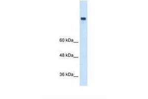 Image no. 1 for anti-Microsomal Triglyceride Transfer Protein (MTTP) (N-Term) antibody (ABIN6738087)