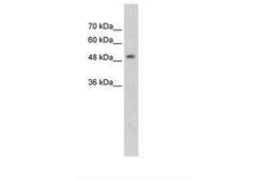 Image no. 1 for anti-Methyl CpG Binding Protein 2 (MECP2) (N-Term) antibody (ABIN203466) (MECP2 antibody  (N-Term))