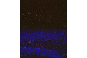 Immunofluorescence analysis of mouse brain using //IB Rabbit mAb (9776) at dilution of 1:100 (40x lens). (Iba1 antibody)