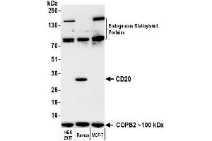 Western Blotting (WB) image for anti-Biotin antibody (ABIN7795729) (Recombinant Biotin antibody)