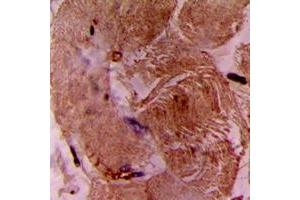 Immunohistochemical analysis of cTnI staining in human heart formalin fixed paraffin embedded tissue section. (TNNI3 antibody  (N-Term))