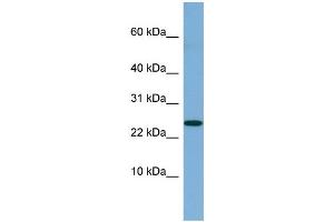 WB Suggested Anti-NBL1 Antibody Titration: 0.
