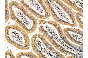 ABIN7093988 and ABIN7098032 at 1/100 staining mouse colorectal tissue by IHC-P.